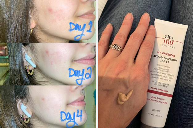26 Skincare Merchandise From Amazon So Effective I Simply Had To Expose You About Them